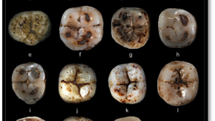 Sample of 15 teeth Zanolli studied for his graduate thesis.